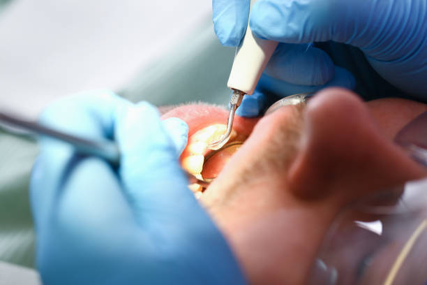 Best Pediatric Emergency Dentist in Murphy, NC