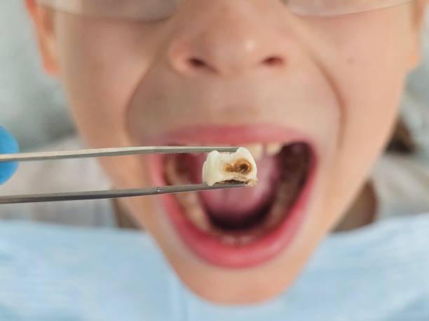 Best Weekend Emergency Dentist in Murphy, NC